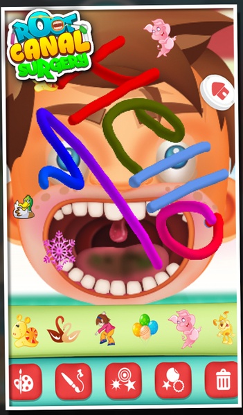 Root Canal Surgery - Preview 1