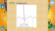 Basic ECG Interpretation screenshot 4