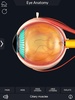 My Eye Anatomy screenshot 5