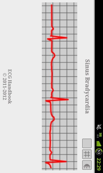 ECG Handbook Trial - Preview 2