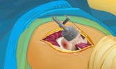 Hip Surgery screenshot 1