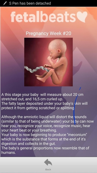 Fetal Beats - Preview 4
