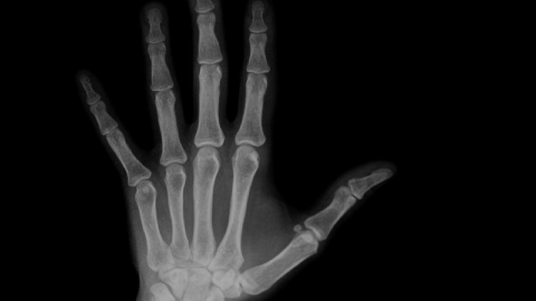 X-Ray Body Scanner - Preview 1