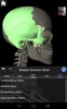 Essential Skeleton 3 screenshot 8