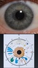Eye Diagnosis screenshot 6
