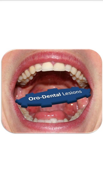 Oro Dental Lesions - Preview 2