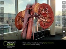 Insight Kidney screenshot 7