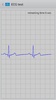 Istel ECG screenshot 4