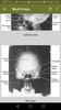 Medical X-Ray with 150+ cases screenshot 1