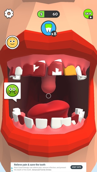 Dentist Bling - Preview 5