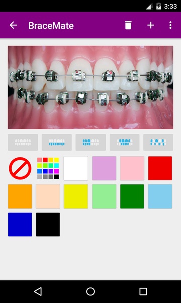 BraceMate - Preview 1