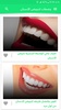 وصفات لتبييض الأسنان وتقويتها screenshot 11