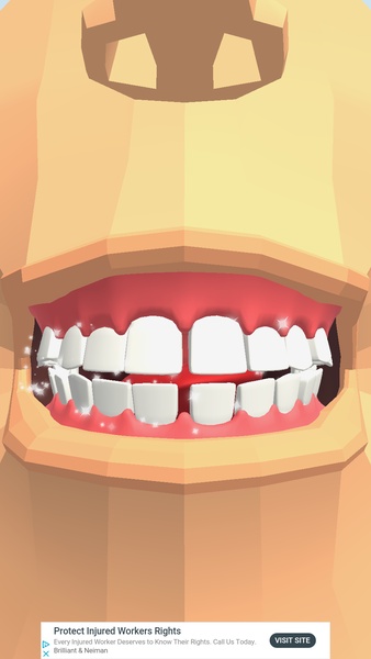Dentist Bling - Preview 7