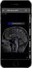 Radiology CT And MRI Anatomy screenshot 5