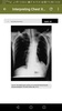 Medical X-Ray with 150+ cases screenshot 2