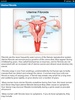 Diet & Help for Uterine Fibroids screenshot 8