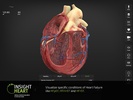 Insight Heart screenshot 6