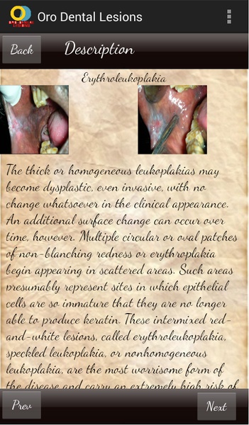 Oro Dental Lesions - Preview 4