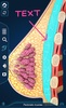 Breast Anatomy Pro. screenshot 8