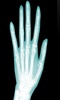 X-RayScanner screenshot 2