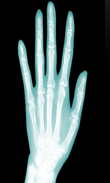 X-RayScanner - Preview 2