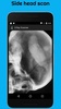 X-Ray Scanner screenshot 4