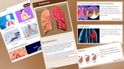 Respiratory Disease &Treatment screenshot 1