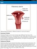 Diet & Help for Uterine Fibroids screenshot 6