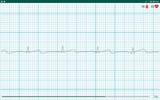 WIWE - ECG diagnostics screenshot 8