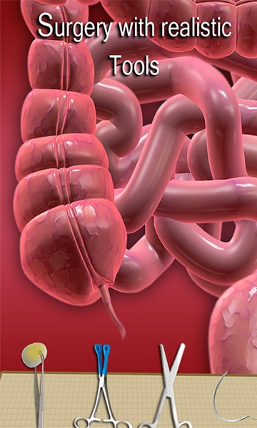 AppendixSurgerySimulator - Preview 2