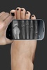 X Ray do scanner screenshot 5