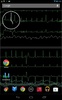 Bedside ECG Monitor screenshot 2