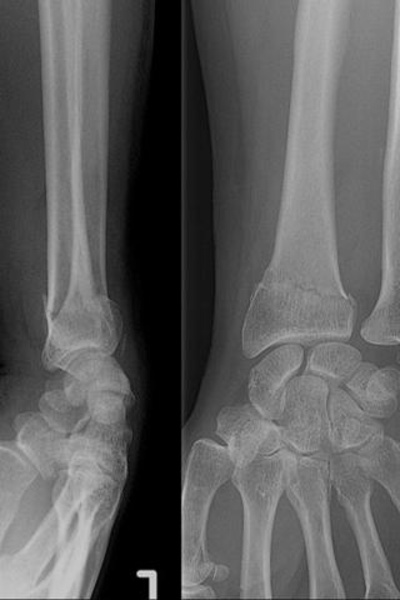 SMARTfiches Orthopedie FREE - Preview 1