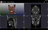 DroidRender - 3D DICOM viewer screenshot 4