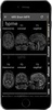 Radiology CT And MRI Anatomy screenshot 4