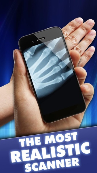X Ray Prank - Preview 2
