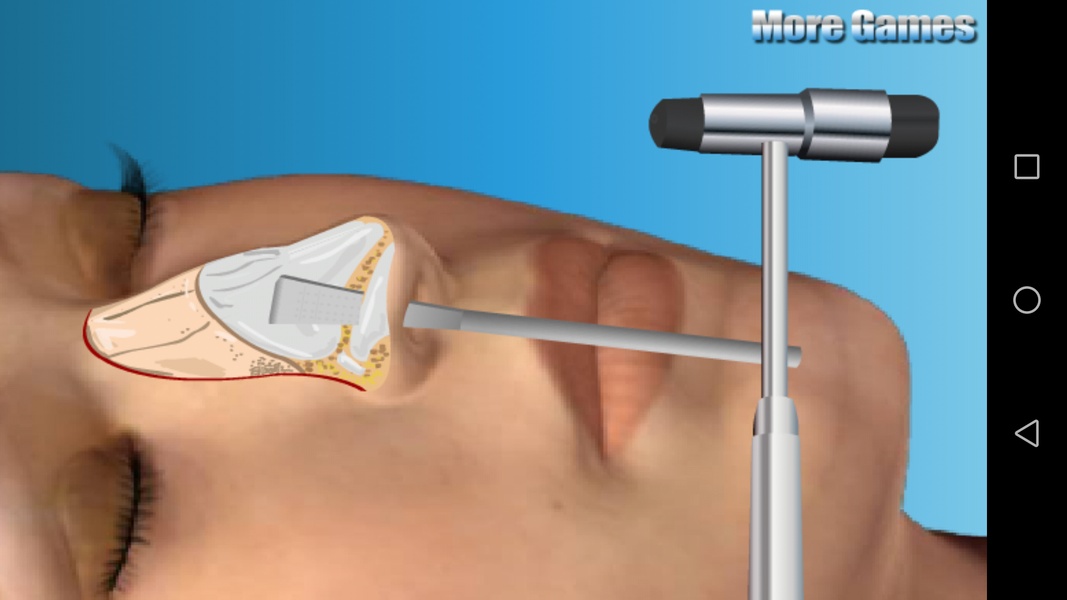 Nose Doctor - Preview 3