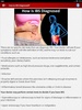 Bowel Stomach Pain & IBS Diet screenshot 3