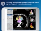 Philips IQon Spectral CT screenshot 3