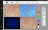 2.0 Artistry Skin Analyzer screenshot 2