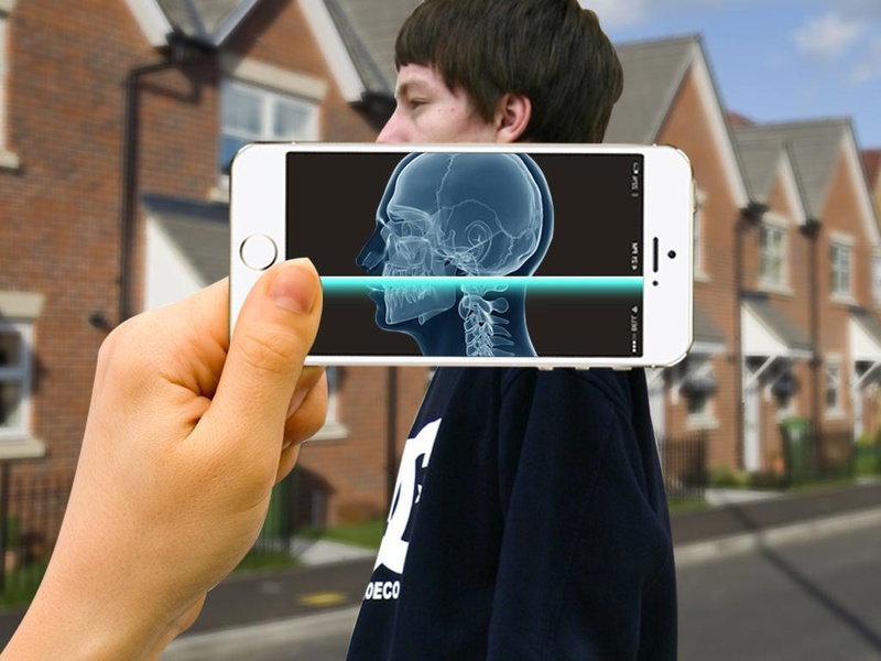 Xray Scan 2 - Preview 3