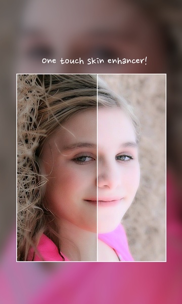 Face Warp - Plastic Surgery - Preview 6