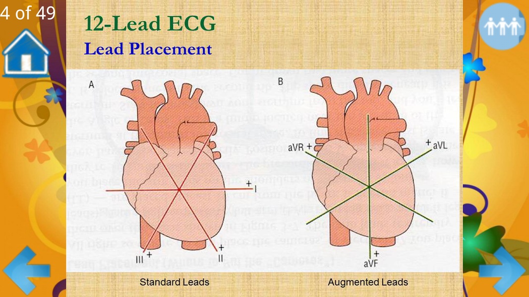 Basic ECG Interpretation - Preview 7
