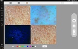 2.0 Artistry Skin Analyzer screenshot 7