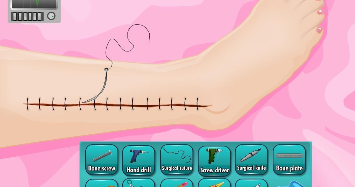 urgent docter leg surgery - Preview 5