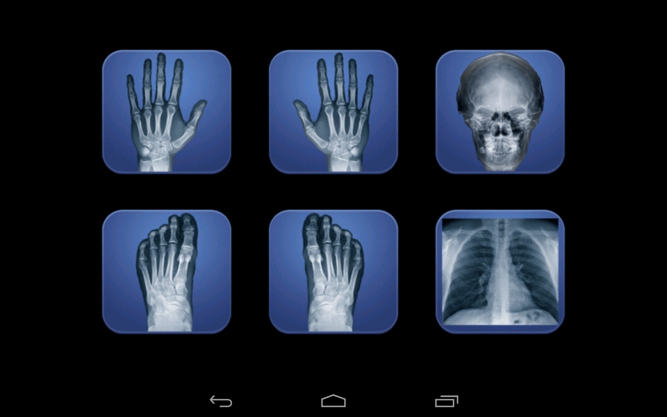 Xray Prank - Preview 5