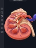 Urinary System screenshot 10