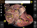 Anatomy 3D Atlas screenshot 7