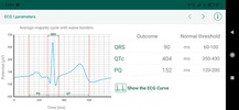 WIWE - ECG diagnostics screenshot 11