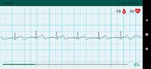 WIWE - ECG diagnostics screenshot 16